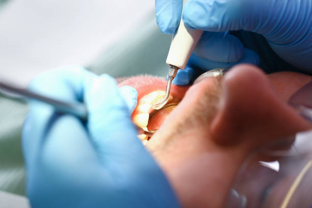 Best Broken Tooth Emergency  in Georgetown, TX